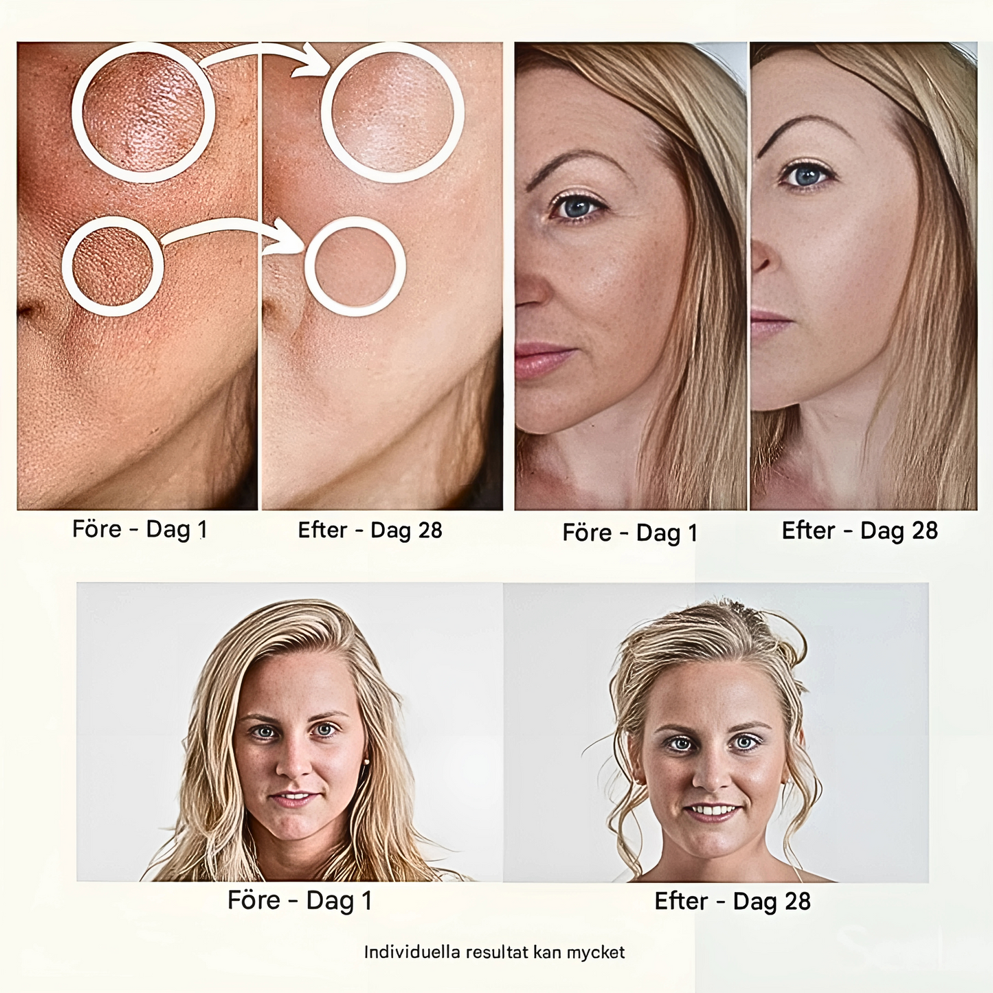 ThermaLift – Facial Device for Skin Tightening | RF, EMS & LED Technology in One