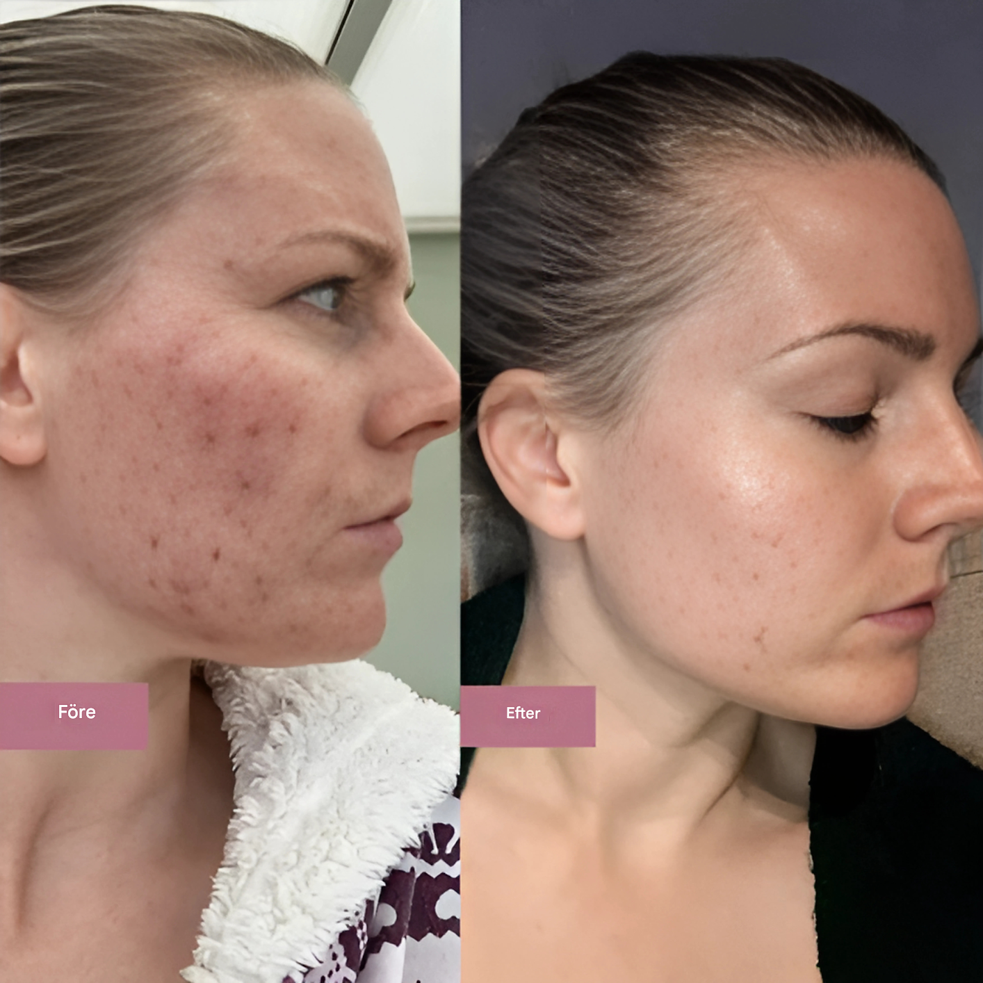 RevitaGlow - Collagen Moisturising Gel Cream for sunn hud