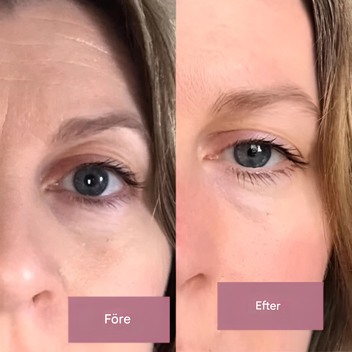 RevitaGlow - Collagen Moisturising Gel Cream for sunn hud