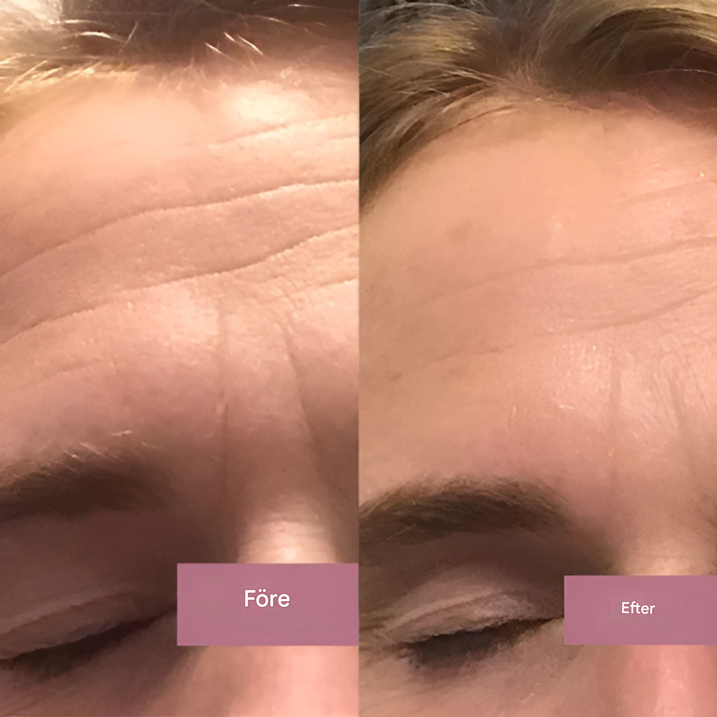 RevitaGlow - Collagen Moisturising Gel Cream for sunn hud