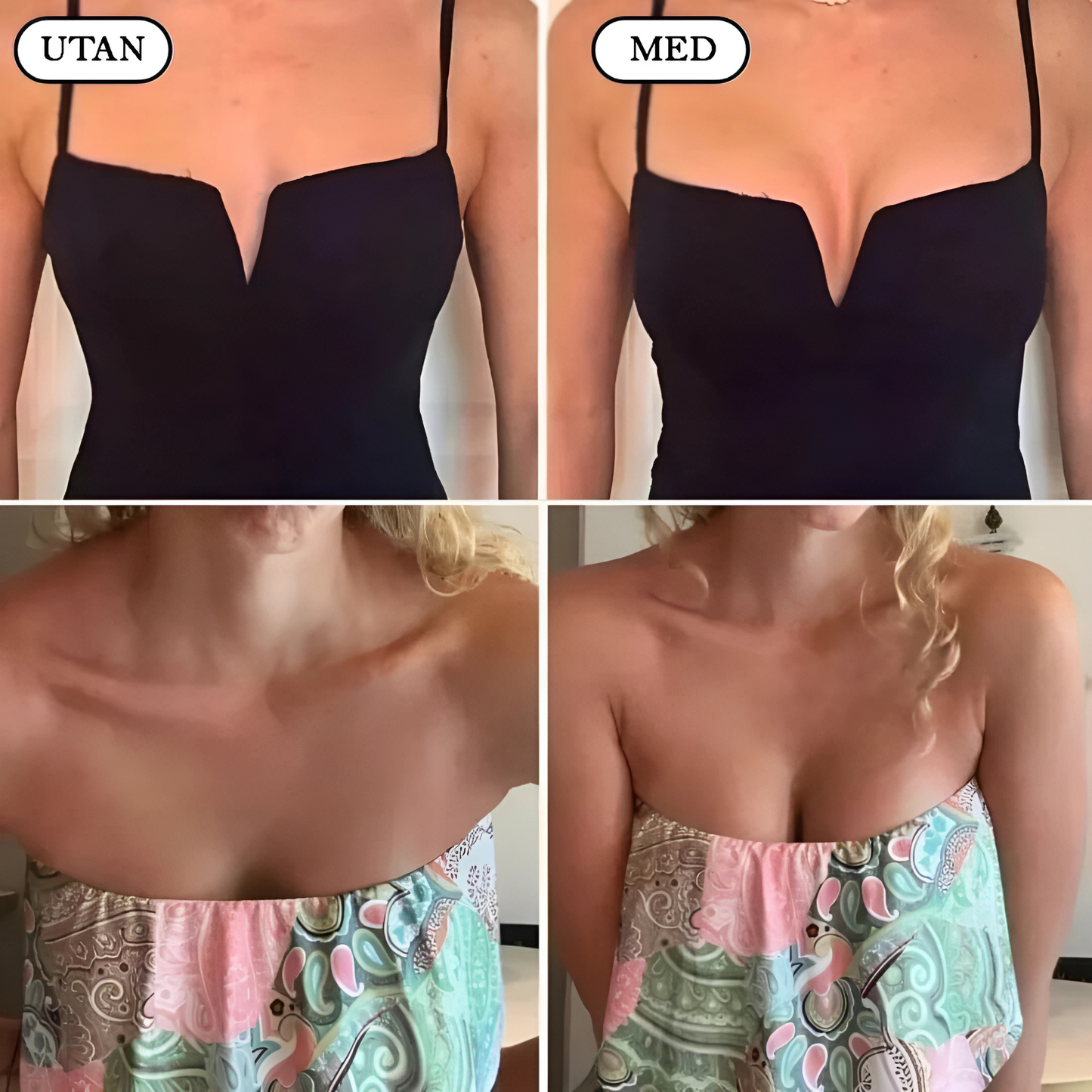 HushForm - Selvklebende push-up-innlegg med diskret løft for åpne rygger og dyp ringing