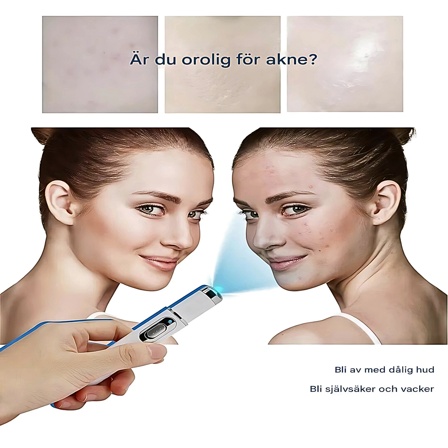 ClariBeam - Blue Light Pen for hudpleie | LED-behandling for ujevnheter, rødhet og hudtekstur