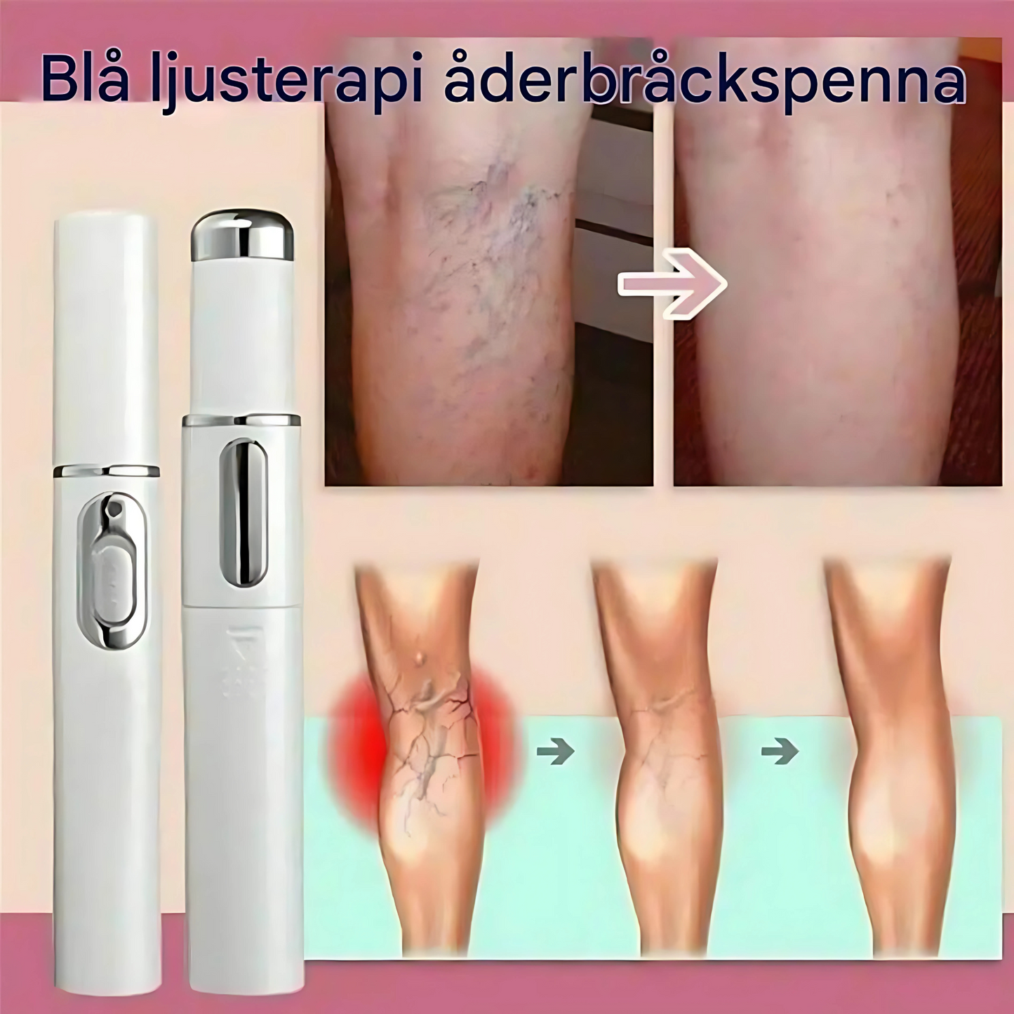 ClariBeam - Blue Light Pen for hudpleie | LED-behandling for ujevnheter, rødhet og hudtekstur