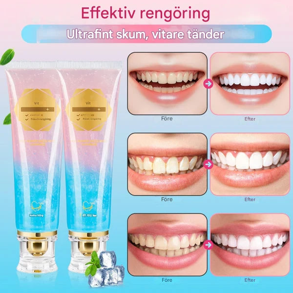 NicoSmile – Whitening Tandkräm med Niacinamid för Fräsch Andedräkt & Mjukare Känsla i Munnen