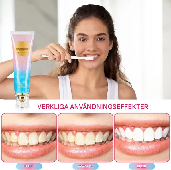NicoSmile – Whitening Tandkräm med Niacinamid för Fräsch Andedräkt & Mjukare Känsla i Munnen