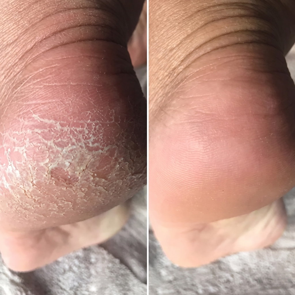 SilkFoot – Elektrisk Fotfil med LED-Ljus och USB-C Laddning – Smidig Hälslipare för Förhårdnader, Torr Hud och Spruckna Hälar Hemma