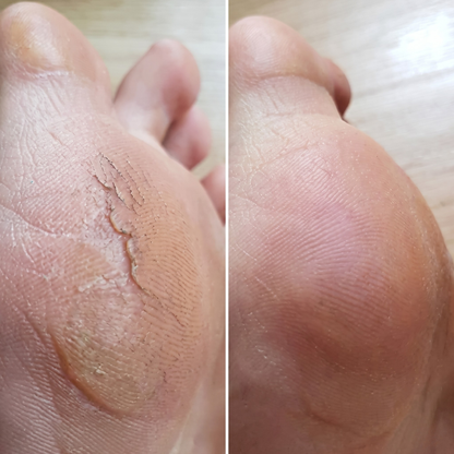 SilkFoot – Elektrisk Fotfil med LED-Ljus och USB-C Laddning – Smidig Hälslipare för Förhårdnader, Torr Hud och Spruckna Hälar Hemma