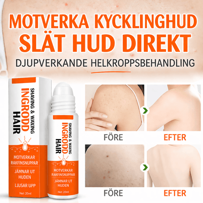 SilkRelief – After Shave Hudvård mot Inåtväxande Hår & Rakirritation