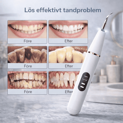 SmileClean – Ultrasonisk Tandstens- og Plakfjerner med LED-lys, 3 Rengøringstilstande og Genopladeligt Design til Hjemmebrug