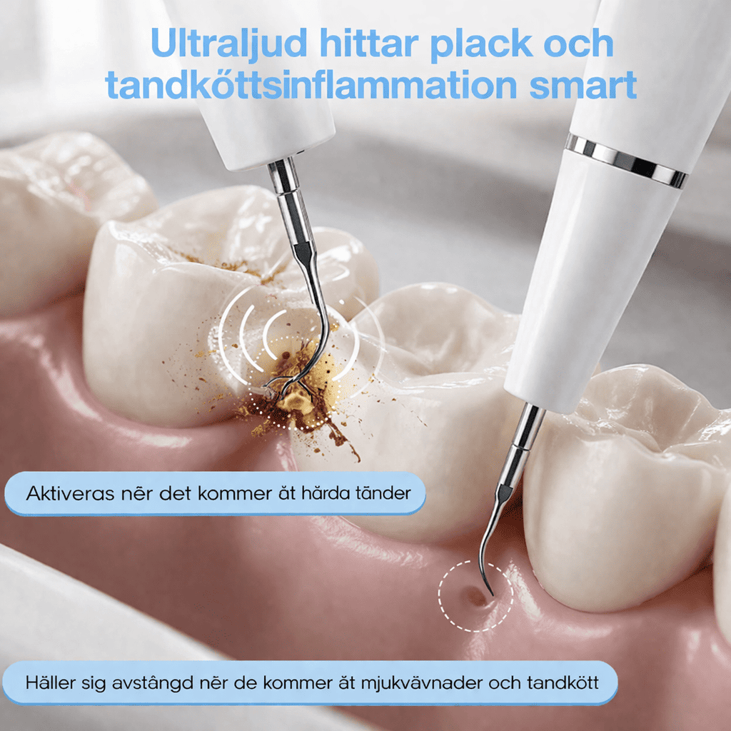 SmileClean – Ultrasonisk Tandstens- og Plakfjerner med LED-lys, 3 Rengøringstilstande og Genopladeligt Design til Hjemmebrug