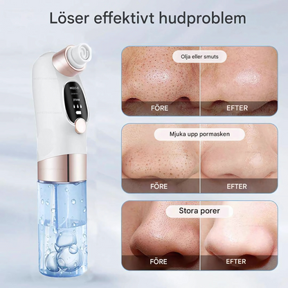 AquaGlow - Ansiktsrens med mikrobobler - skånsom porerensing med vakuum og vannkretsløp