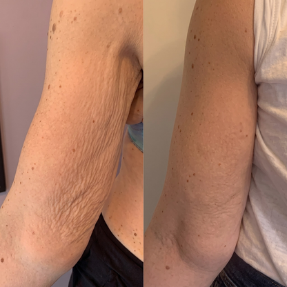 VelvetFirm – Åtstramande Kroppskräm med Retinol, Hyaluronsyra, Ceramider och Plant Squalane
